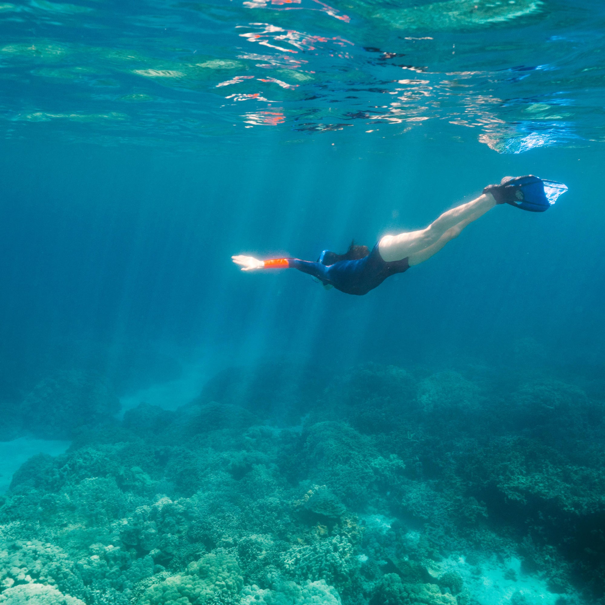 Restoring a healthy ecosystem – probiotics supplements to support a healthy gut microbiome